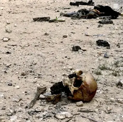 Human skull in Gaza