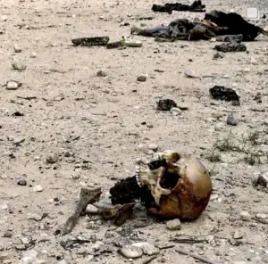 Human skull in Gaza